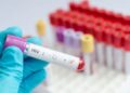 Man in Germany cured of HIV according to new study