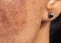 Sea Spot Saver for Stubborn Sunspots and Hyperpigmentation
